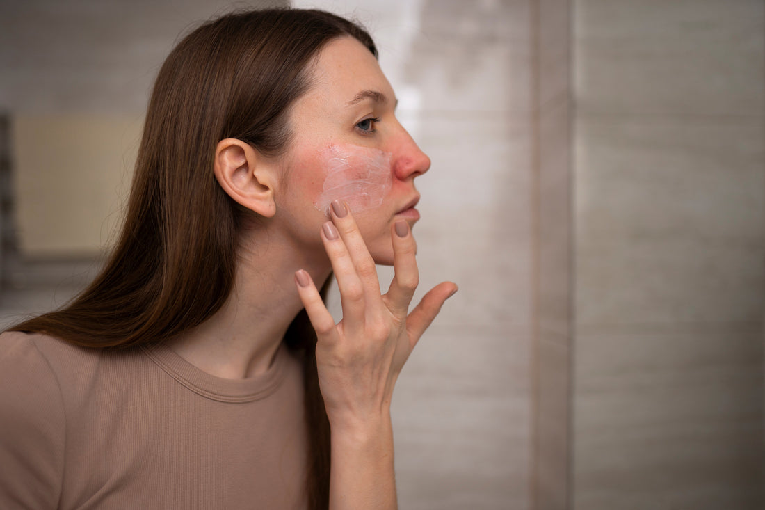 Peau sensible : 7 signes que ta routine ne te convient pas (et comment y remédier)